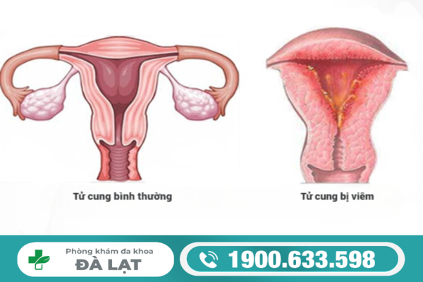 Hình ảnh minh họa